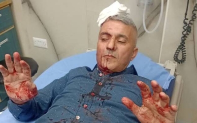 اعتداء مسلح يستهدف الصحفي فارس الحباشنة في عمّان