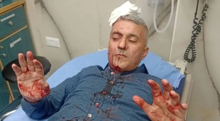 اعتداء مسلح يستهدف الصحفي فارس الحباشنة في عمّان