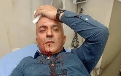 نقابة الصحفيين تدين الاعتداء على الصحفي فارس الحباشنة