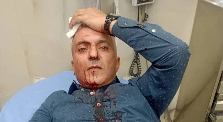نقابة الصحفيين تدين الاعتداء على الصحفي فارس الحباشنة
